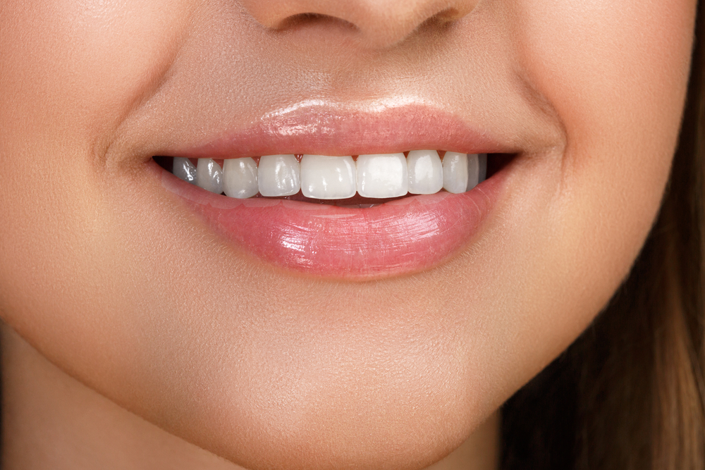 Close-up of a woman’s bright, healthy smile